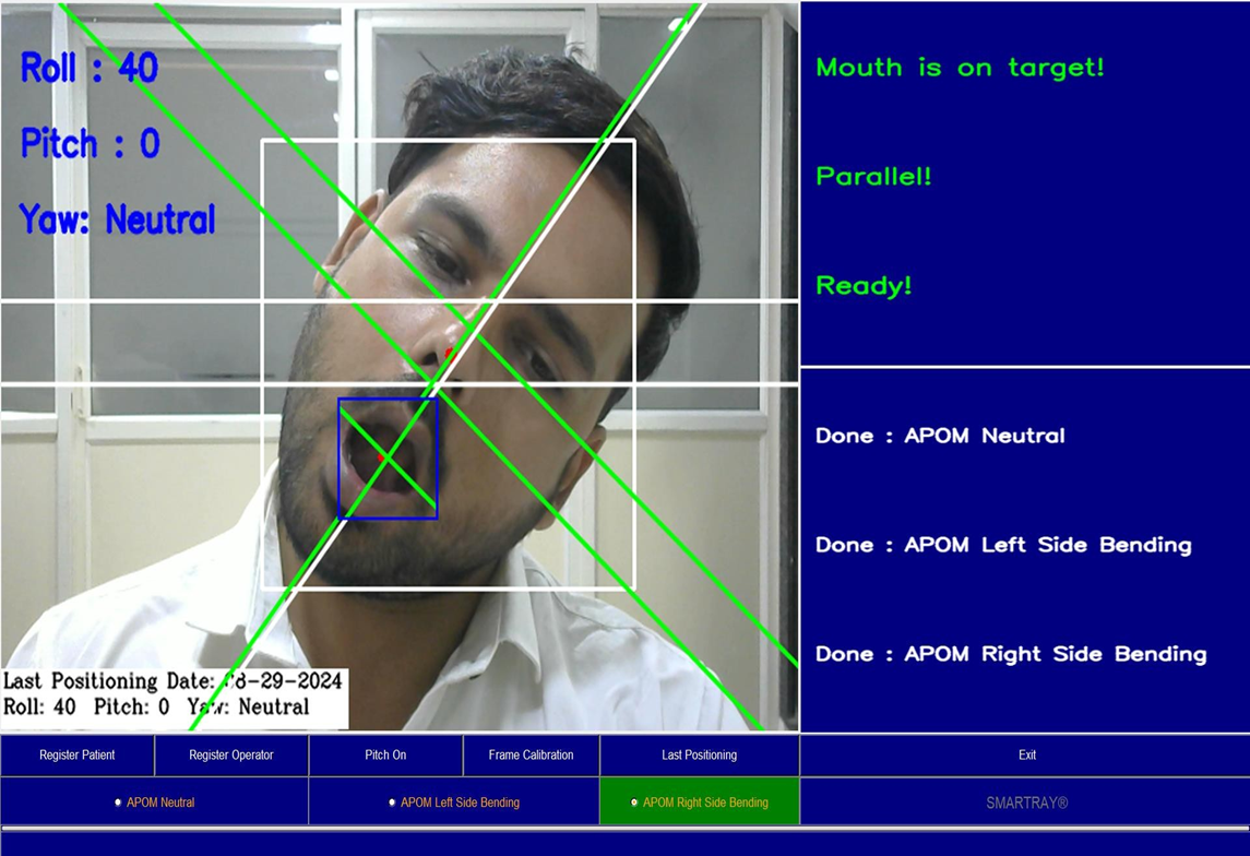 Right side bending AP open mouth workflow